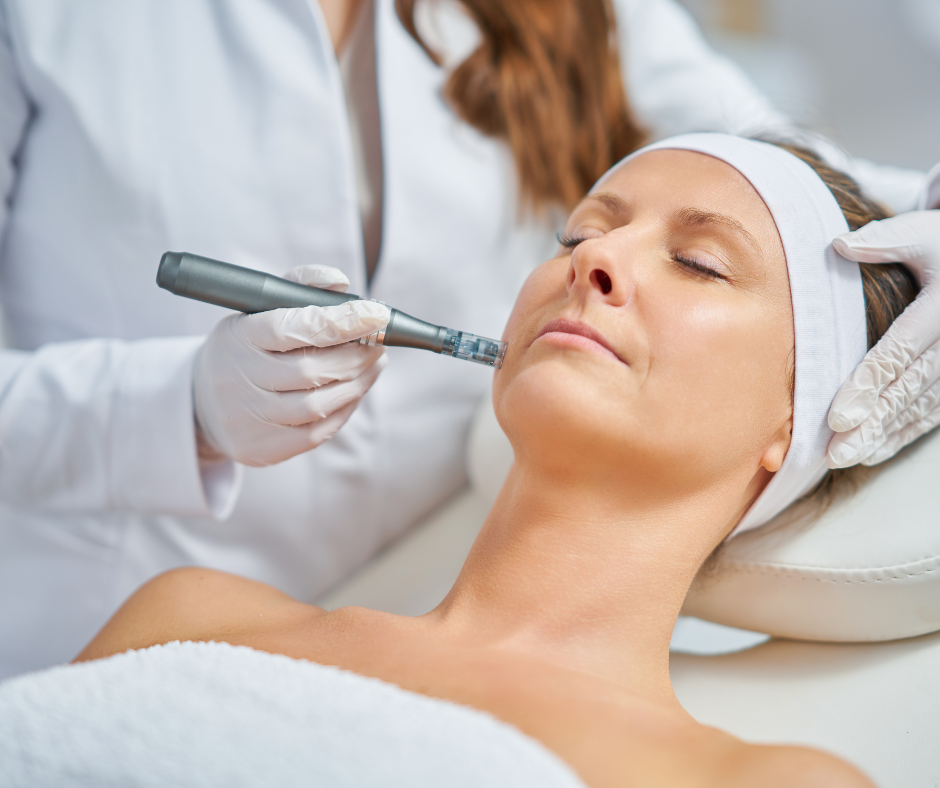 Microneedling + Radio-Frequency Treatment