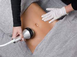 Lipocavitation + Laser Treatment + Radio-Frequency
