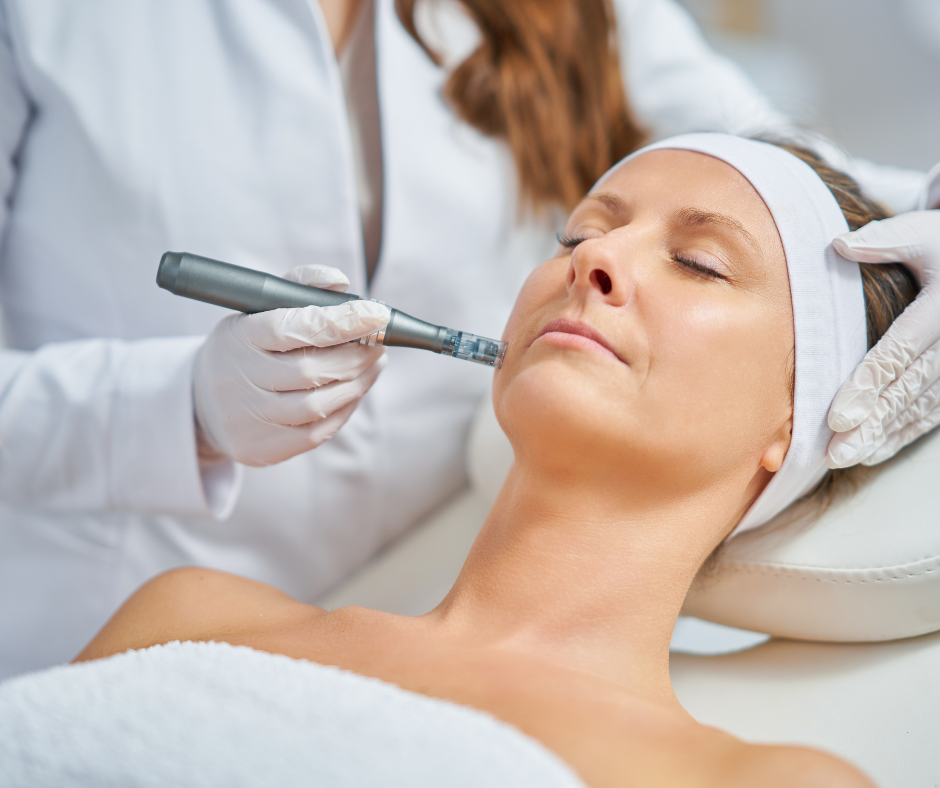 Microneedling Treatment